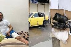 العتبة الحسينية تتكفل بعلاج المواطن الذي أضرم النار بسيارته في كركوك